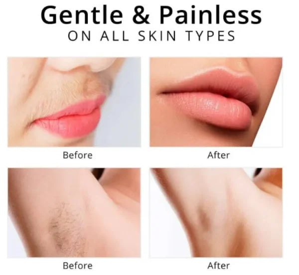 2 In 1 Flawless Facial Hair Removal | USB Chargeable