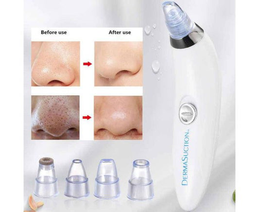 Premium Blackhead Removal Machine-derma Suction 4 In 1 (Cell Operated)